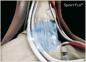 SportVis SportVis